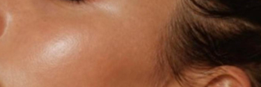 Cortisol face : le stress se voit-il vraiment sur notre peau ?